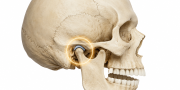 Çene Eklemi Ağrısı Neden Olur? TMJ Problemlerinde Fizyoterapi Ne İşe Yarar?