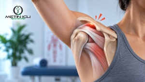 Omuz sıkışma sendromu rotator cuff ve kolu kaldırırken omuz ağrısı